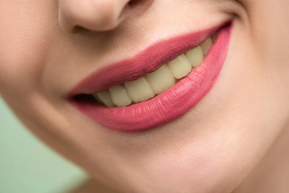 Sonrisa antes del blanqueamiento